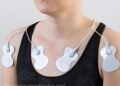 Editorial photo for: AI Tool Detects Hidden Heart Disease From a Standard ECG